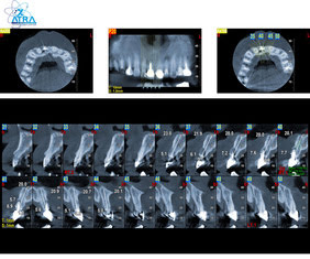 عکس CBCT دندان چیست؟+ مزایا و کاربردها