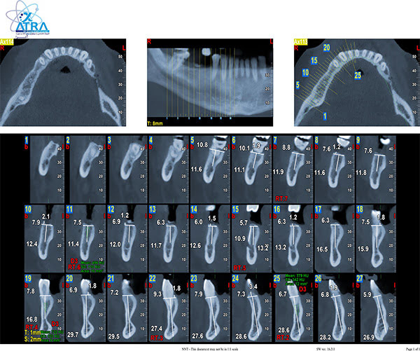 radiology-OPG-pacs