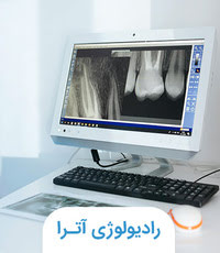 تصویربرداری برای ایمپلنت دندان در شیراز: CBCT، OPG و روش‌های نوین