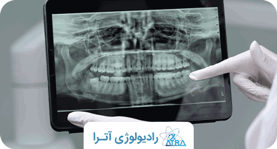آمادگی های لازم قبل از عکس CBCT دندان