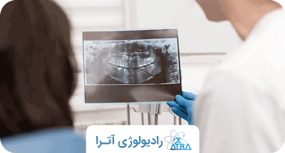 چرا رعایت ایمنی در پرتو درمانی دندان حیاتی است؟ 
